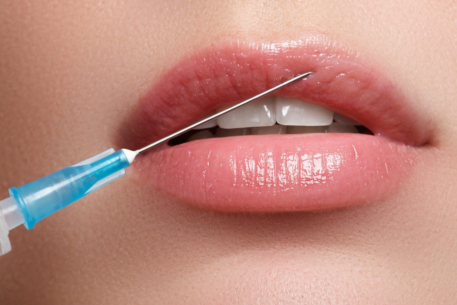 plastische chirurgie